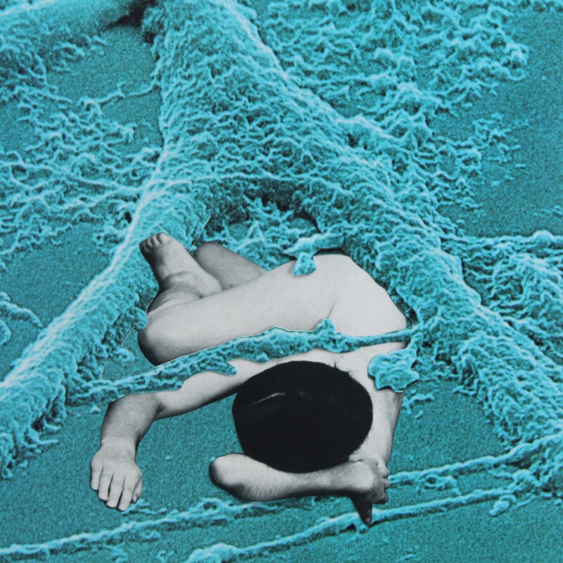 Collage. Boy in black and white sleeps curled up in a microscopic image of body tissue in blue. 