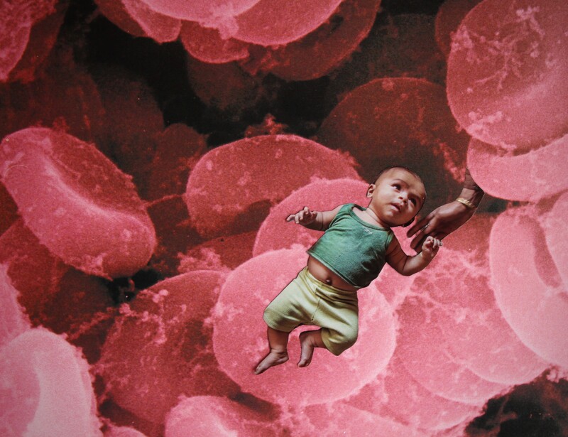 Infant floats in an image of blood cells while holding a disconnected hand